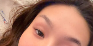 五輪金メダル最有力・クロエ・キムに激震!本番目前、肩脱臼という最悪のアクシデント